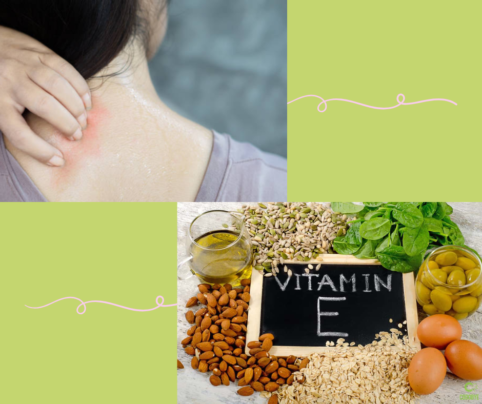 thiếu vitamin E gây ngứa da