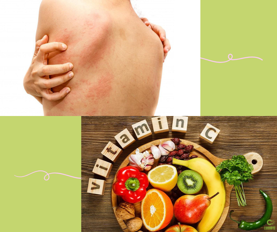 Thiếu vitamin C gây phát ban
