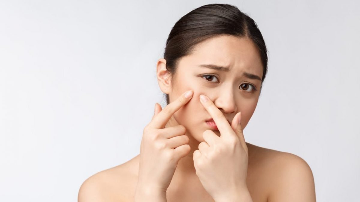có nên dùng kháng sinh trị mụn
