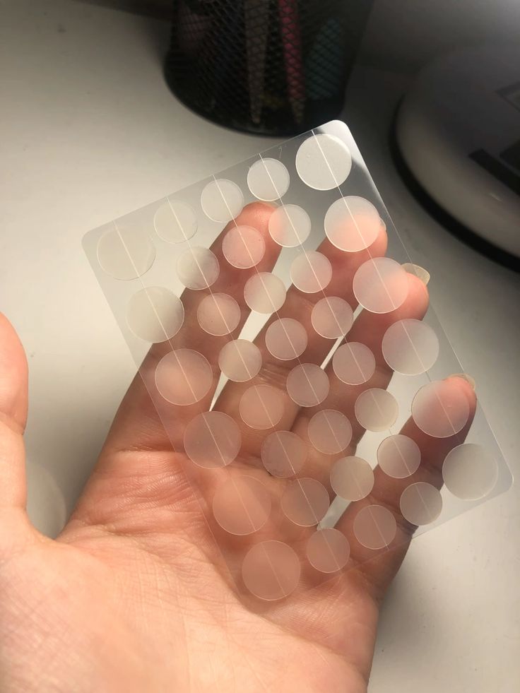 Miếng dán mụn có thực sự hiệu quả?