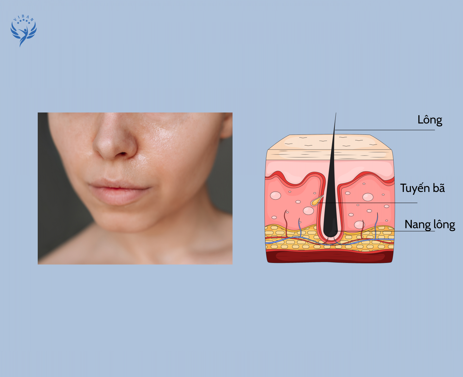 Tuyến bã nhờn ở tuổi teen hoạt động mạnh do tăng hormone androgen