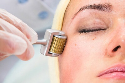 Cách trị mụn bằng lăn kim gây nhiễm trùng da trầm trọng bạn biết chưa?