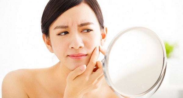Có rất nhiều nguyên nhân gây mụn
