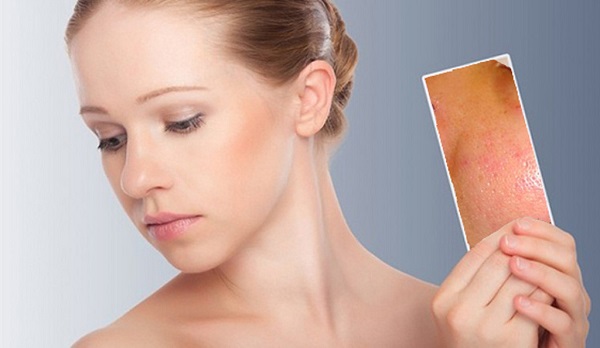 Da mặt lúc nào cũng bóng nhờn, phải làm sao?