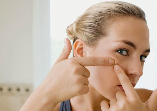 Đánh bay nỗi lo về mụn nhờ viên uống trị mụn trứng cá