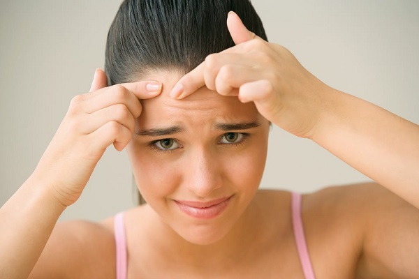 Đâu là giải pháp ngăn ngừa mụn trên trán?