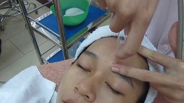 Hút mụn chỉ là phương pháp tạm thời