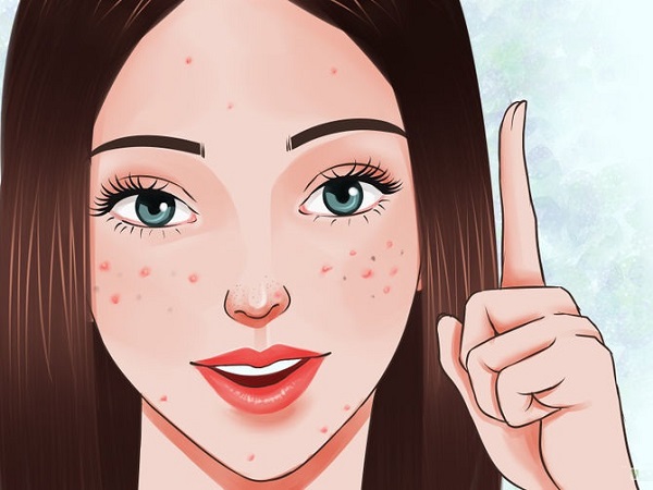 Khi bị mụn trứng cá có được phép make - up không?