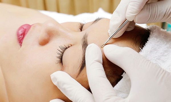 Không nặn mụn khi chưa chín