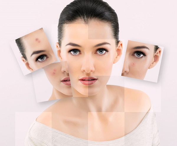 Làm sao để điều trị mụn tận gốc