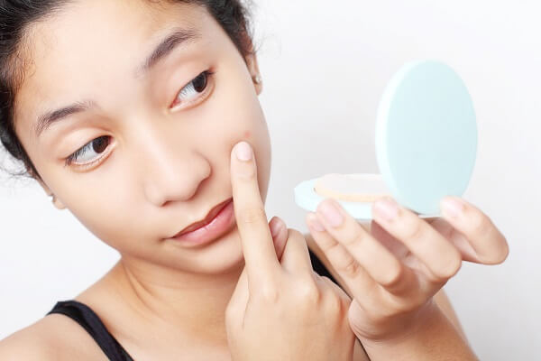 Làn da thường bóng dầu ở vùng chữ T