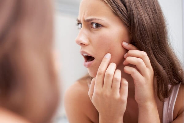 Mụn ẩn thường khó trị và lâu hết