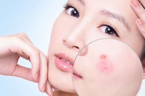 Nhận diện da dầu