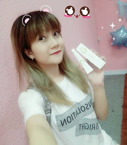Sau khi sử dụng kem trị mụn trứng cá Codobye Cream