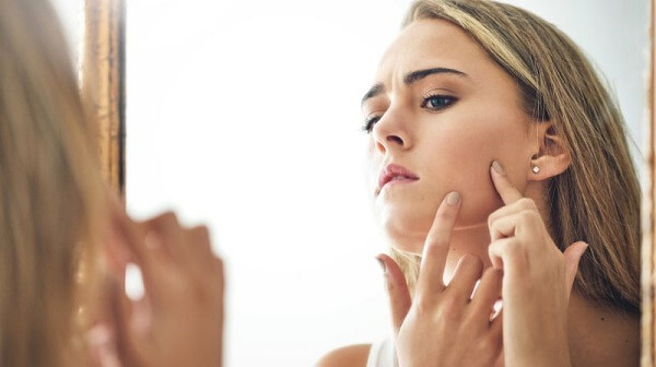 Tác hại không ngờ đến của việc nặn mụn không đúng cách