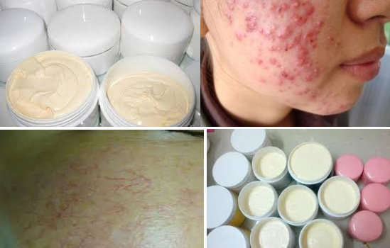 Tránh xa kem trộn, rượu thuốc không có chứng nhận kết quả rõ ràng