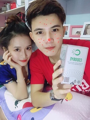 Viên uống trị mụn đẹp da được giới trẻ yêu thích hiện nay